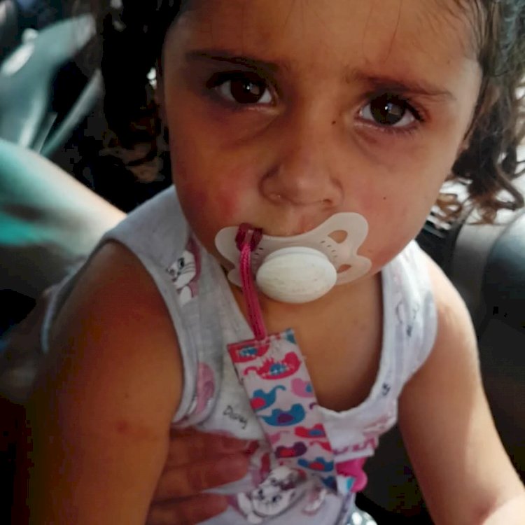 Mãe Denuncia Falta de Atenção em Escola de Marília Durante Crise Alérgica Grave que Poderia Ser Fatal